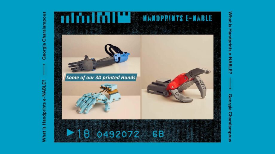 Collage of 3 3D printed prosthetic hands.
