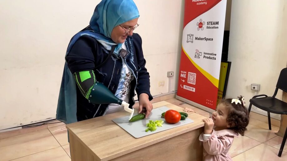 A mother with partial arm loss using a 3D printed arm device to chop vegetables on a table.